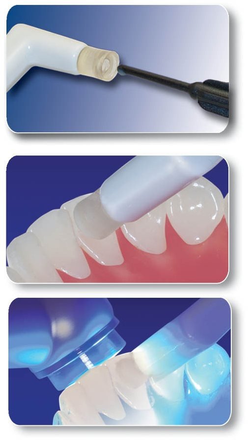 Set 6 conformatoare silicon pentru accesorii ortodontice din compozit