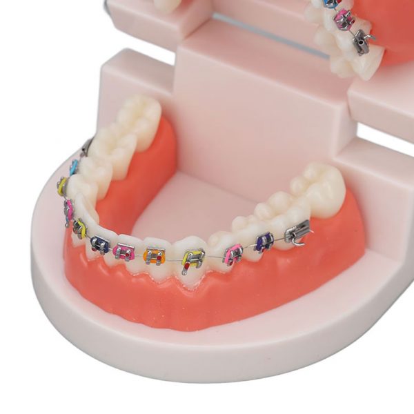 Model dentar plastic 28 dinti cu bracketi ortodontici