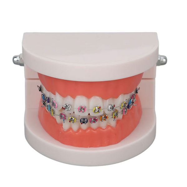 Model dentar plastic 28 dinti cu bracketi ortodontici