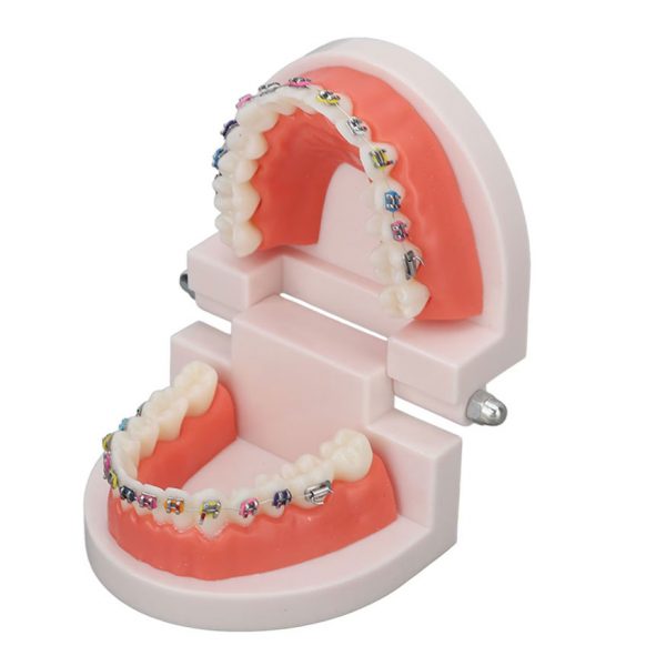 Model dentar plastic 28 dinti cu bracketi ortodontici