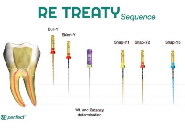 ReTreaty ace endo pentru retratament D Perfect